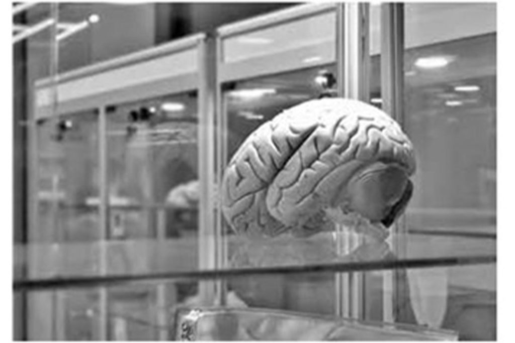 Beyin İmplantları Hafızayı Yüzde 20 Artırıyor