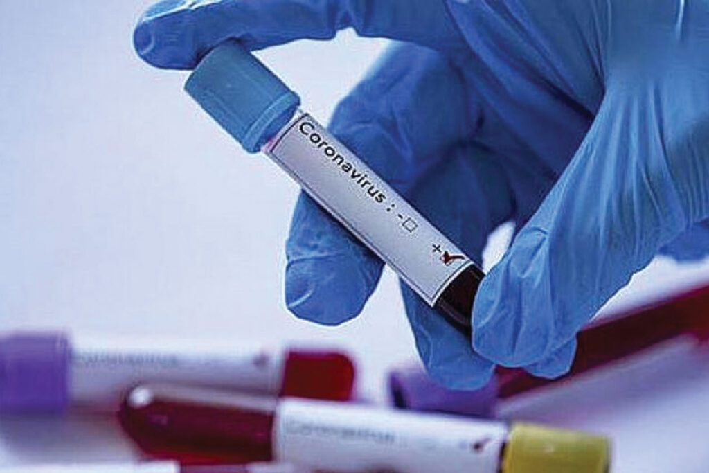 B12 vitamini koronavirüs riskini azaltıyor